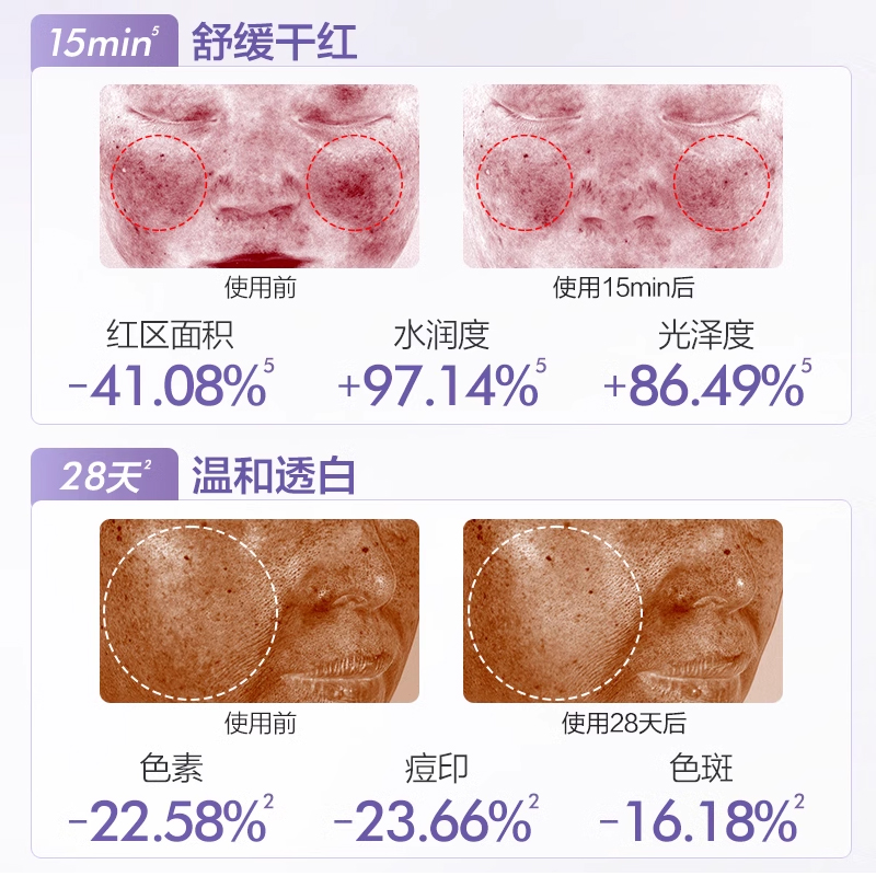 欧诗漫安心水乳套装美白修护保湿敏感肌舒缓女官方旗舰店官网正品 - 图3