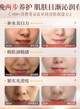OHBT澳白樱花熊果苷美白精华水乳去黄提亮抗氧化补水保湿护肤品女