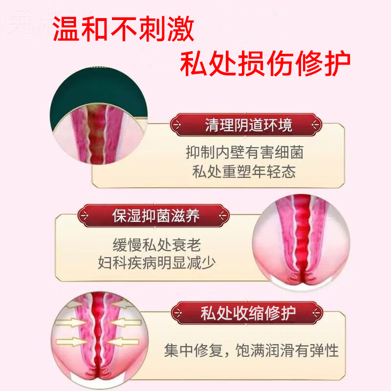 女性私处水润阴道紧致收缩阴道宫漏尿修复盆底肌神器阴道松正品hy - 图1