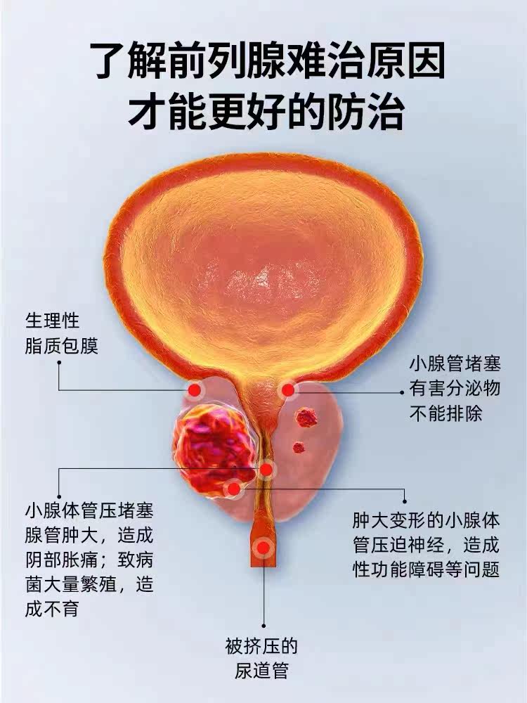  思立普理疗仪（器械）