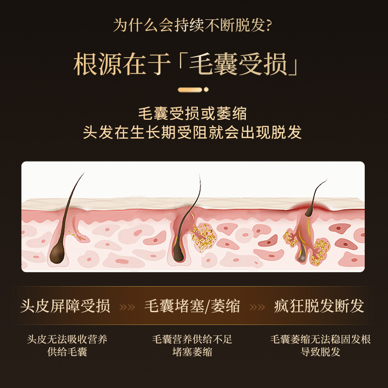 侧柏叶防脱洗发水去屑控油毛囊激活原液
