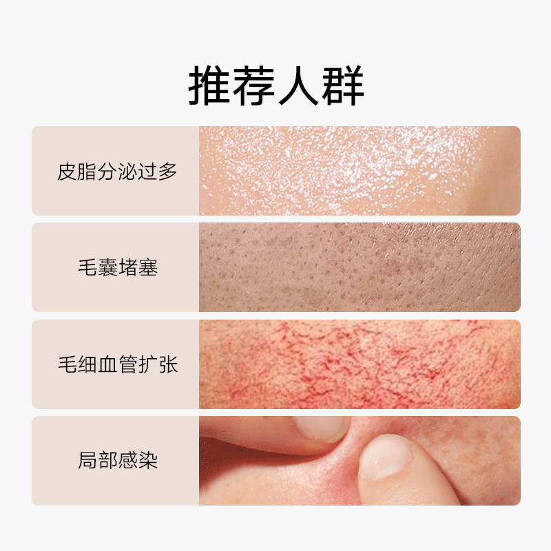 Cos De BAHA 10%壬二酸精华痘痘肌肤专用护肤品祛痘痘印修复淡化 - 图2