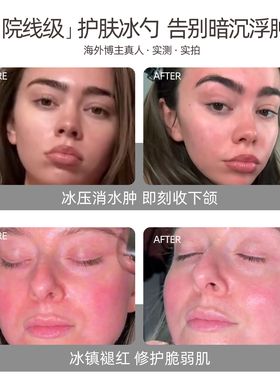 pfeFe护肤美容仪冷敷冰勺冰锤冰敷仪提拉肌肤减少水肿面部按摩仪
