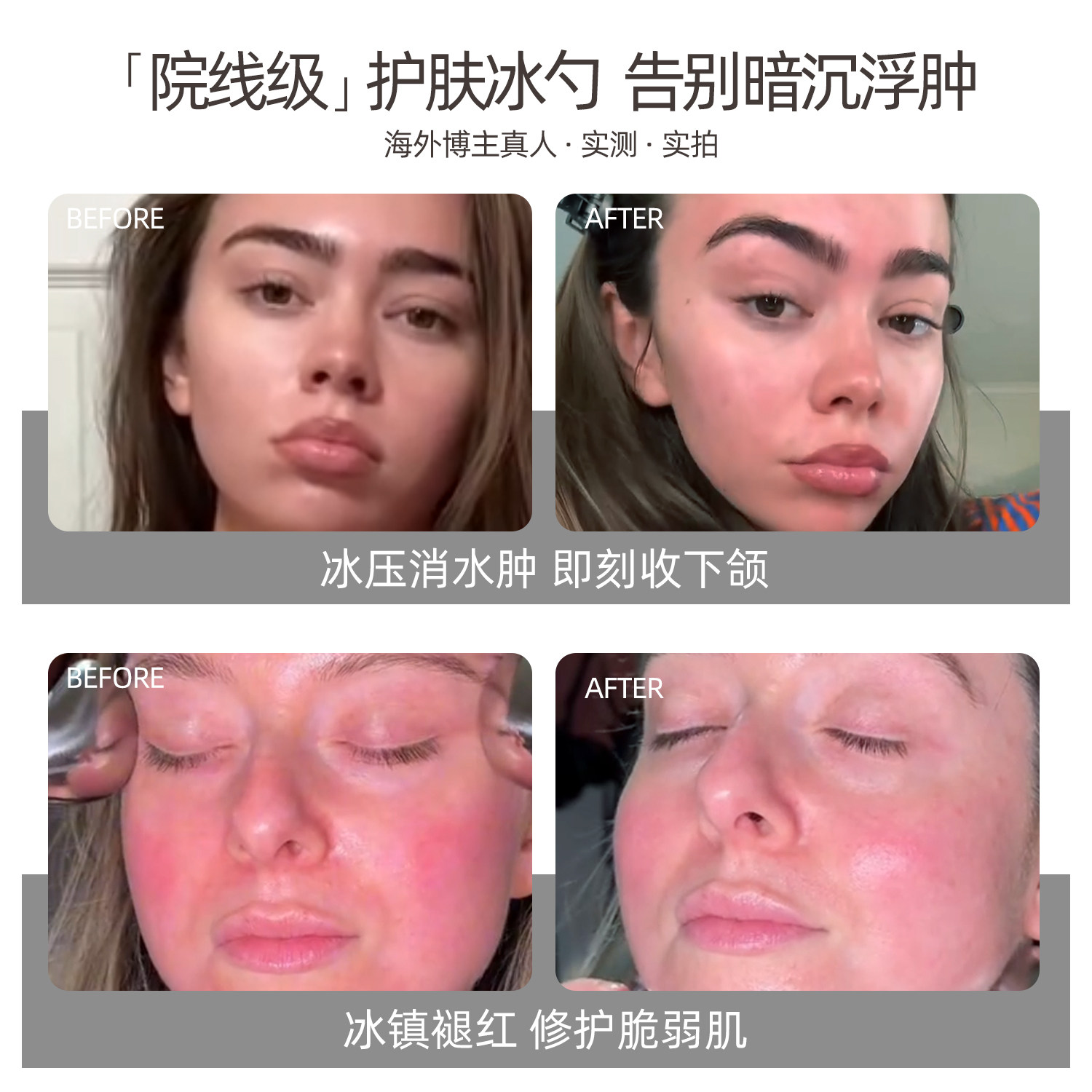 PFEFE冰勺美容按摩脸部美容仪器护肤面部消肿冰敷眼部冰锤冷敷仪