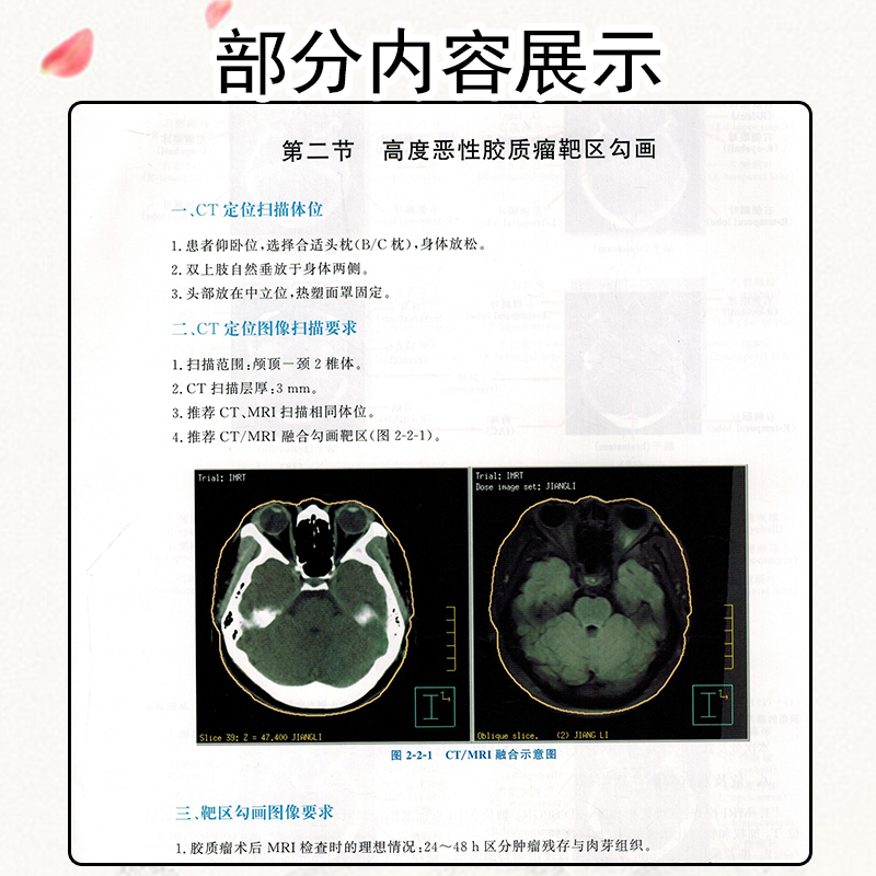 【书】肿瘤精准放疗靶区勾画图谱主编袁双虎宋启斌肿瘤疾病临床案例诊治教程内科学参考书籍湖北科学技术出版社书籍-图3