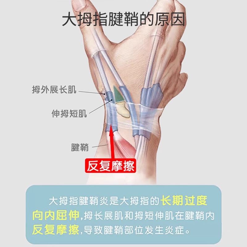 妈妈手薄款护腕手腕大拇指固定关节支具鼠标手腱鞘专用透气保护套 - 图0