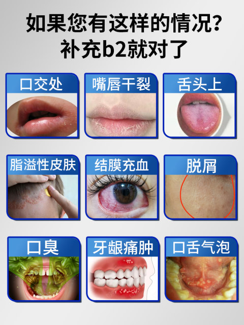 Oral Metabolic Fatigue Immune Complex B Complex