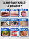 Oral Metabolic Fatigue Immune Complex B Complex