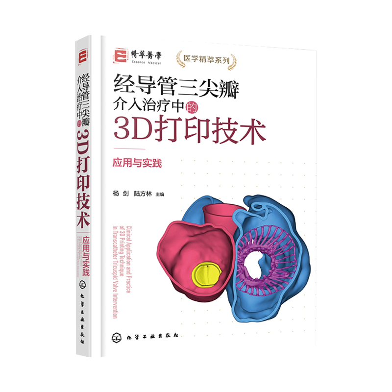 经导管三尖瓣介入治疗中的3D打印技术 应用与实践 化学工业出版社 超声心动图在TTVI中的应用 三尖瓣的数字化建模及3D打印方法