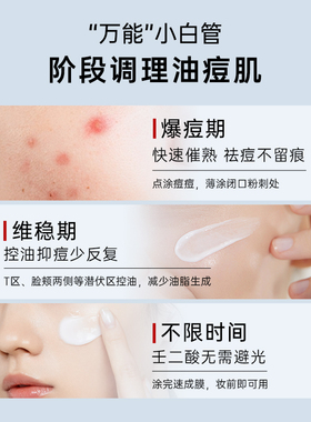 小样尝鲜|质润祛痘凝胶超有效