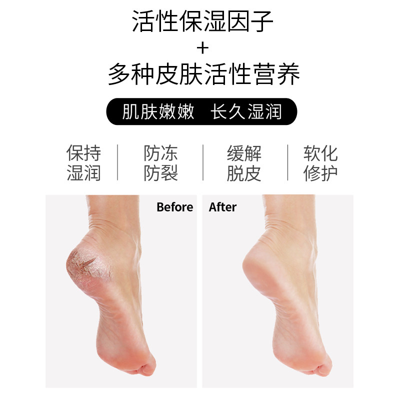 桑得鹅油膏滋润保湿防皴抗裂护手霜 桑得护手霜