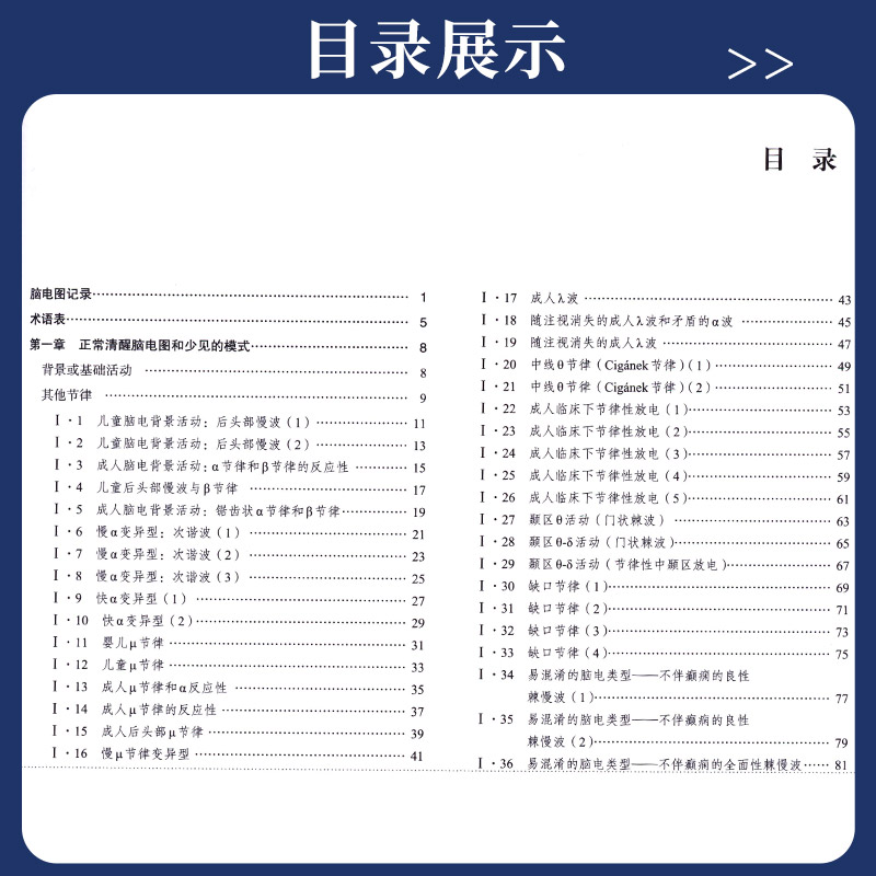 【正版包邮】清醒和睡眠脑电图 任连坤等译脑电图图谱卷正常清醒脑电图和少见的模式 共包括180幅脑电图 中国协和医科大学出版社