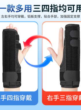 骨骨折固定器夹板基底部手指关节