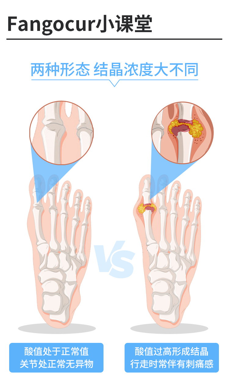 Fangocur方哥火山疗土胶囊小安瓶平衡酸值嘌呤代谢非芹菜籽鹅肌肽-图3