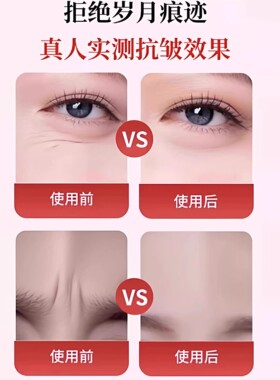 川字纹贴日本淡化眉间贴法令纹防皱眉神器额头贴提拉紧致睡觉专用