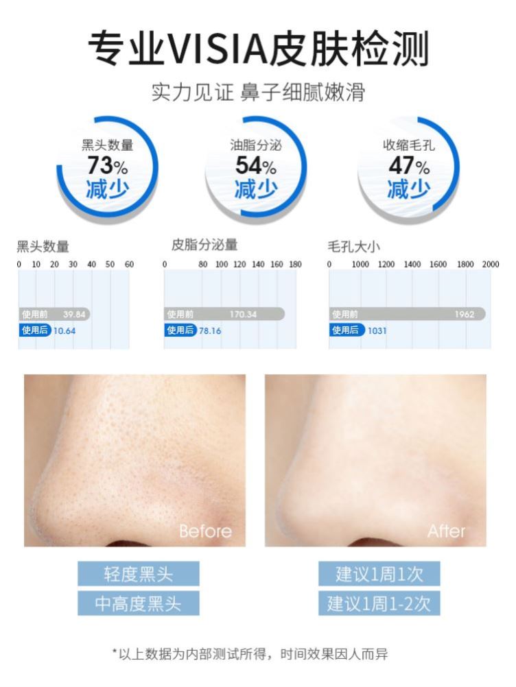 美国进口鼻贴去黑头粉刺闭口导出液收缩毛孔神器海外旗舰店ohbt - 图1