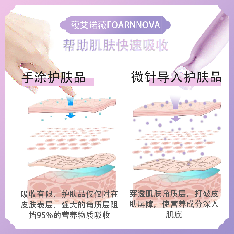 FN馥艾诺薇面部滚轮微针导入仪家用脸部精华护理眼周细纹滚针痘坑