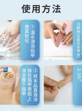 【手趾通用】专用草本植物灰指甲增厚抑菌液膏药亮甲效特真菌感染