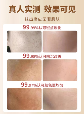 老年斑强力去除手部脸部祛黄褐斑雀斑老人去斑专用祛斑霜官方正品