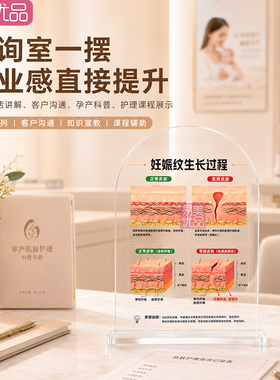 妊娠纹形成原理科普摆台孕产护理咨询亚克力展示牌皮肤结构讲解教