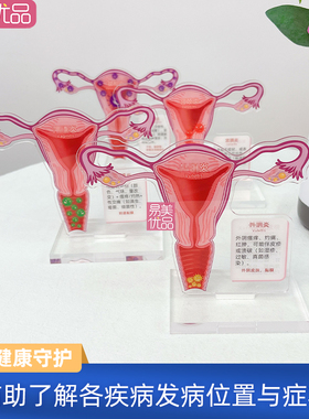 美容院场景摆件产康女性健康守护亚克力摆件月经周期医患沟通工具