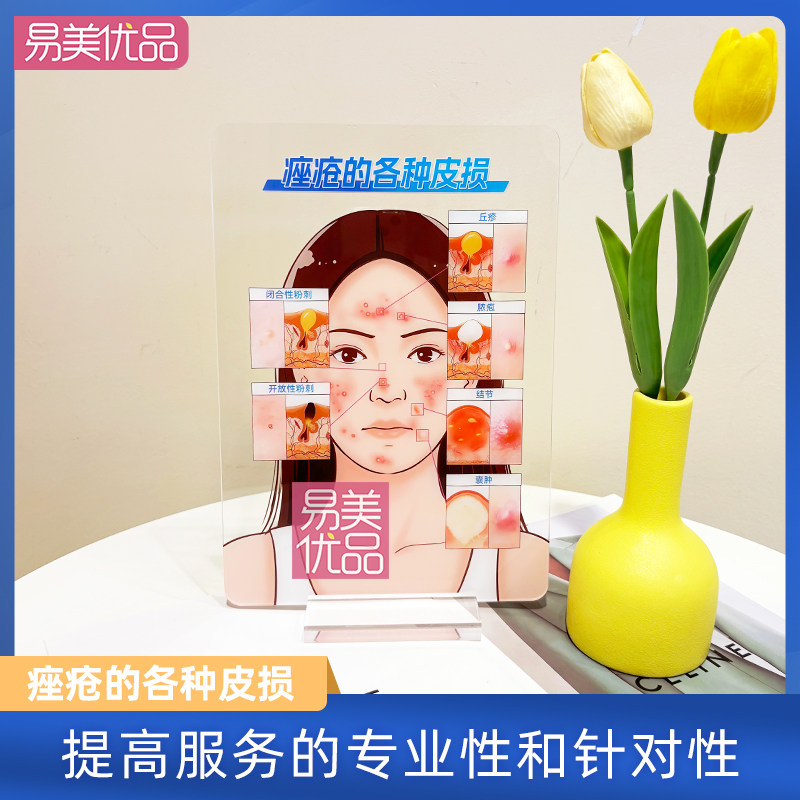 专业皮肤美学教具痤疮的各种皮损亚克力展示牌医患沟通项目介绍物