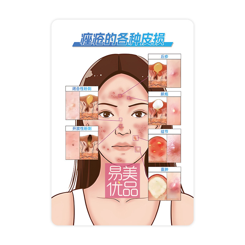 专业皮肤美学教具痤疮的各种皮损亚克力展示牌医患沟通项目介绍物