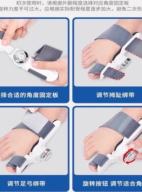 日本正品脚指矫正器】15天见效！