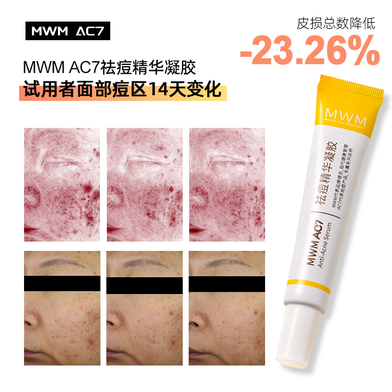 MWM祛痘膏AC7精华液闭口粉刺生物微针正品-图1