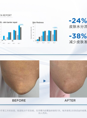 sesderma赛斯黛玛光感身体乳保湿