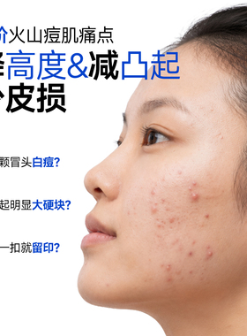 贝芙汀清颜点涂祛痘凝乳