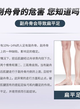 副舟骨突出鞋垫足舟骨疼痛矫正器重度扁平足高低脚竹弓儿童矫正