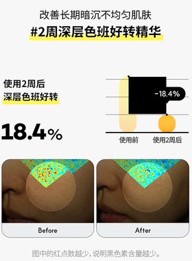 韩国STANDARD SEOUL弹力液态安瓶紧致补水保湿发光提亮气球精华