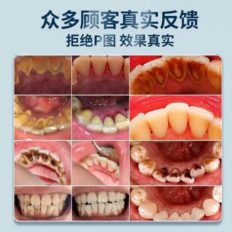 细砂牙齿打磨器磨牙美牙黄牙砂轮牙菌斑洁牙清洁仪器家用抛光机-图1