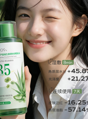 原B5爽肤水芦荟积雪草女男士补水保湿控油舒缓