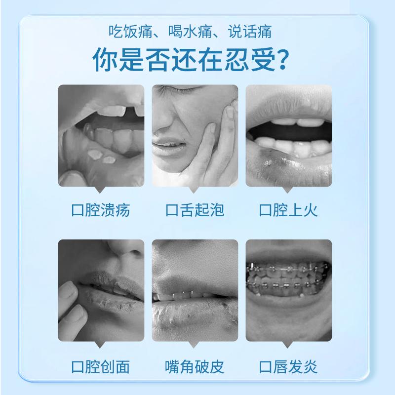 葵花口腔溃疡凝胶炎症缓解疼痛软膏舌头溃疡专用嘴巴上火起泡烂贴-图0