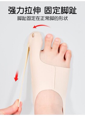 拇指固定袜大脚趾矫正袜拇指外翻拉力带脚趾分离袜套大脚骨训练器