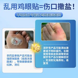 仁和水杨酸去老茧鸡眼贴专用膏祛除鳮茧眼根脚钉跖疣尤平软化剂