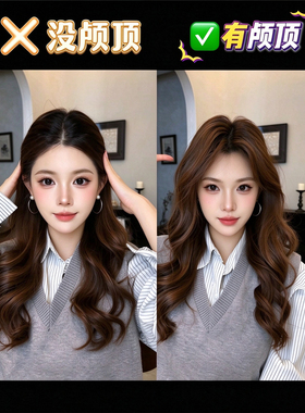 女士发根蓬松夹子高颅顶定型