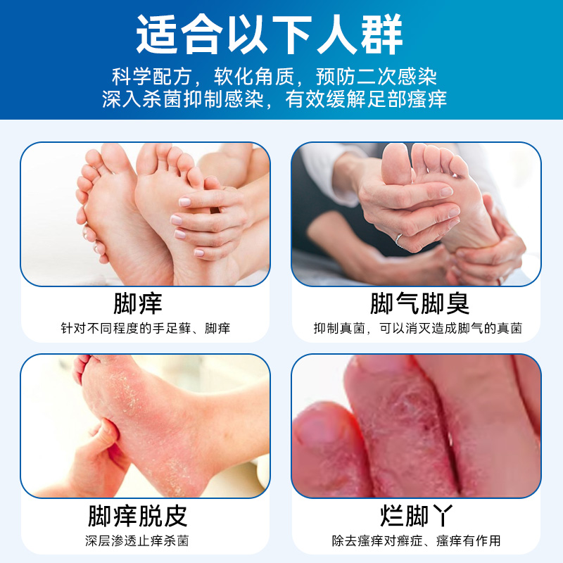 日本小林制药水虫液止痒脚气水脚丫痒足癣泡脚臭烂杀菌消炎脚气水