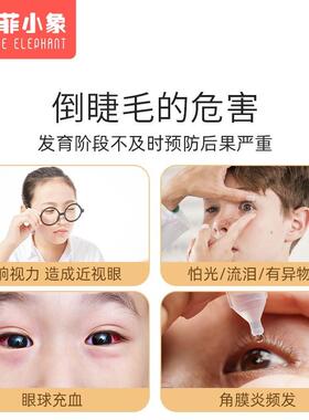 儿童倒睫毛矫正贴敏宝零感觉低超宝薄上眼睑NHX拉倒睫提毛贴神器
