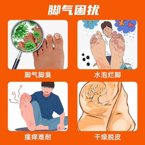 太平 硝酸咪康唑乳膏手真菌感染手足癣头癣体股癣手上起小水泡等 - 图0