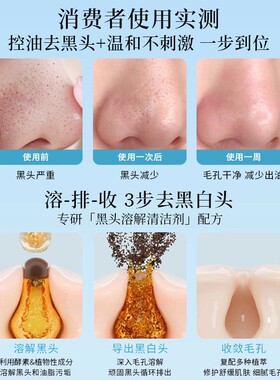 黑头导出液木瓜蛋白酶去黑头美容院专用和收缩毛孔黑头水粉刺神器