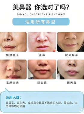 维媞琋塑鼻条物理塑型收紧鼻背鼻翼立挺鼻梁鼻头翘鼻神器