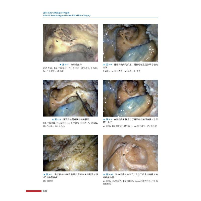神经耳科与侧颅底手术图谱(印)莫瓦尼//纳拉扬·贾亚山97875046931292022-04-01