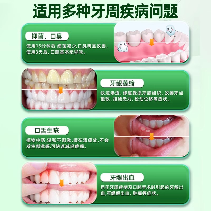 喉咙痛牙痛西帕依固龈泡腾片牙齿酸软咀嚼无力牙龈出血蒲地蓝消炎