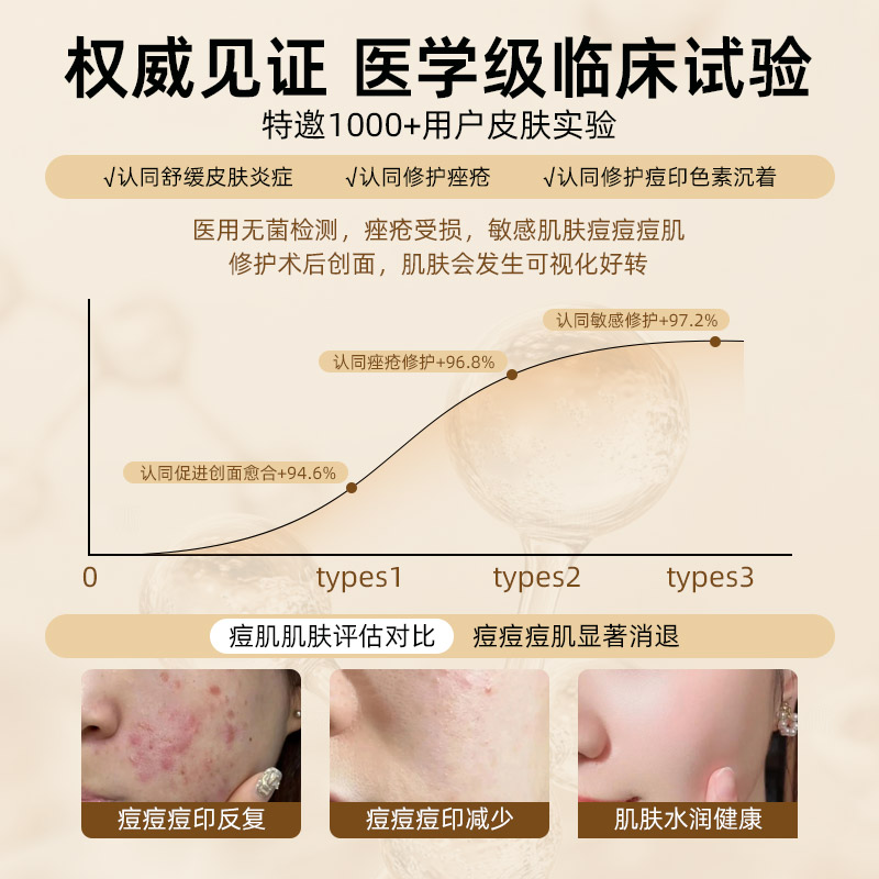 医用冷敷贴面膜型医美正品官方旗舰店非修补水复女保湿无菌痘痘贴