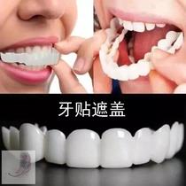 Tooth patch cover tooth slit large false tooth set tooth simulation false tooth slit fill Divine Instrumental Door Aligner large Tooth Slit