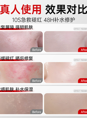 【胖东莱热销】晒后急救舒缓面膜