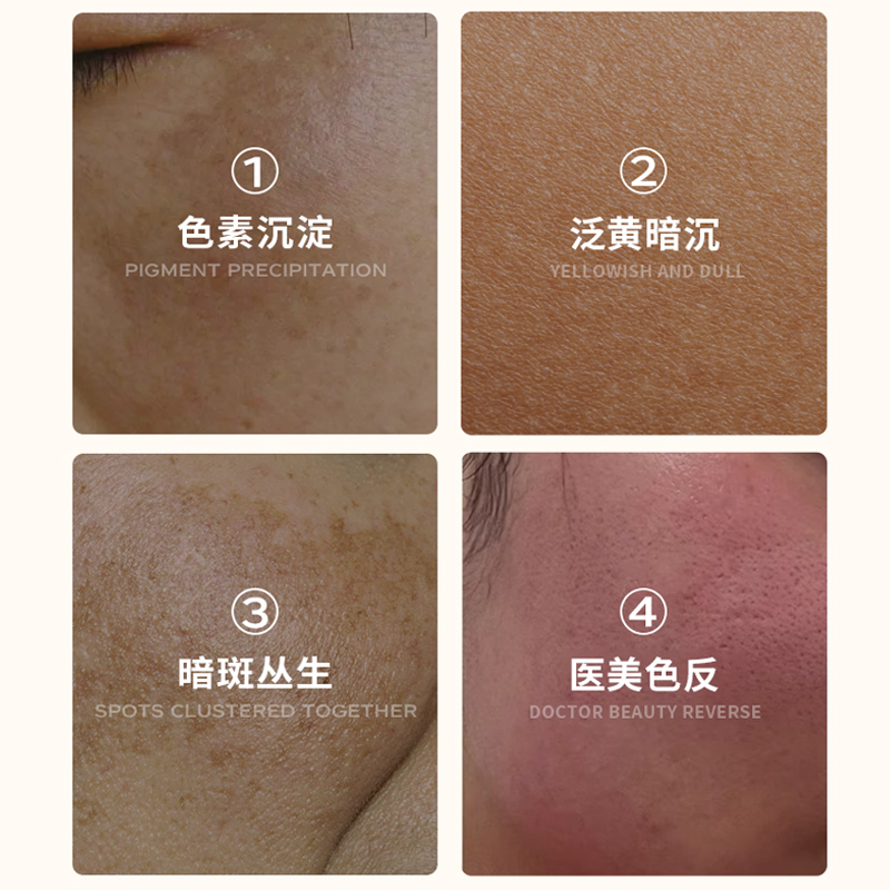 赛隆悦佳氨甲环酸精华液传明酸高浓度去黄提亮面部补水修护5ml